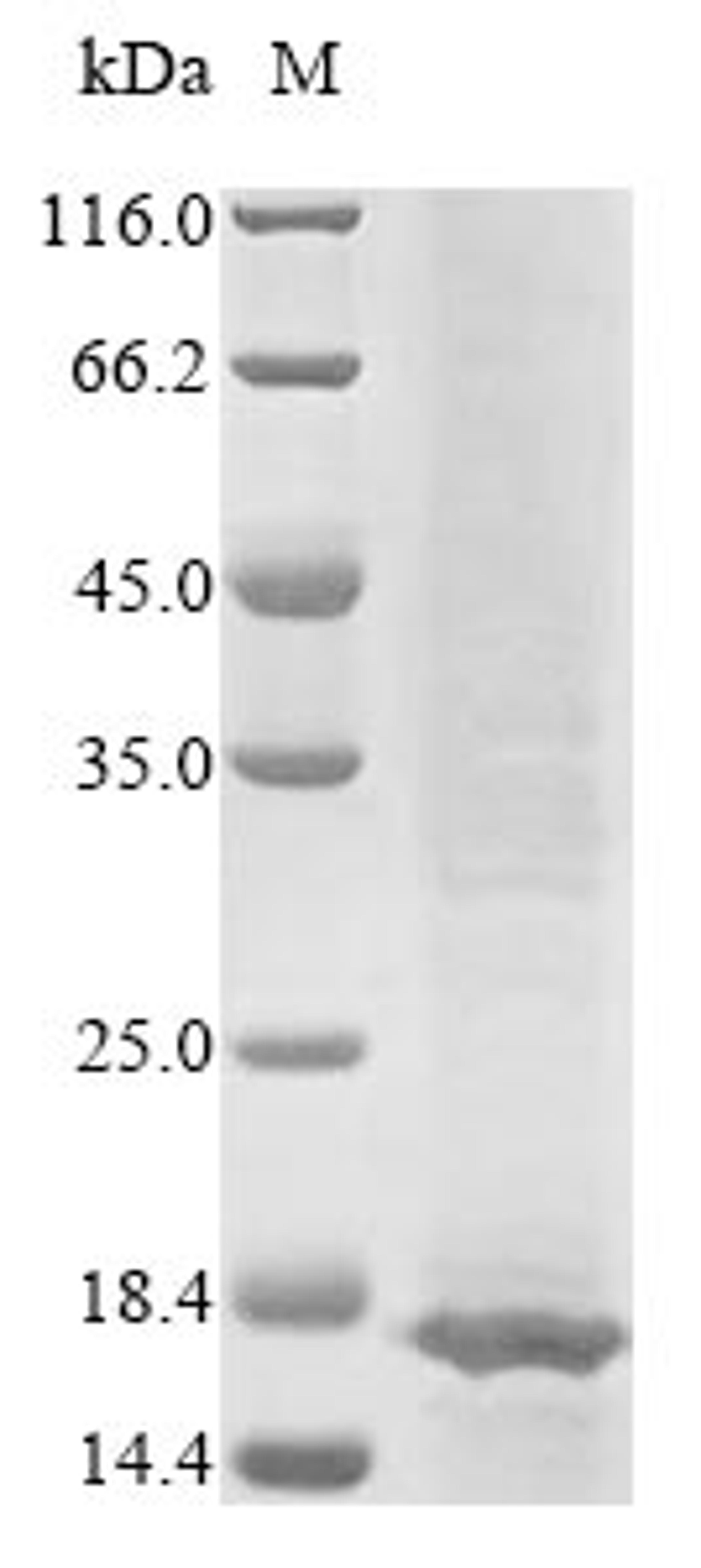 (Tris-Glycine gel) Discontinuous SDS-PAGE (reduced) with 5% enrichment gel and 15% separation gel.