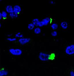 Immunocytochemistry/Immunofluorescence: C9RANT Antibody [NBP2-25018] - Anti-C9RANT-immunoreactive neuronal inclusions in the cerebellum of a c9FTD/ALS case. Image contributed by Tania Gendron (Mayo Clinic).