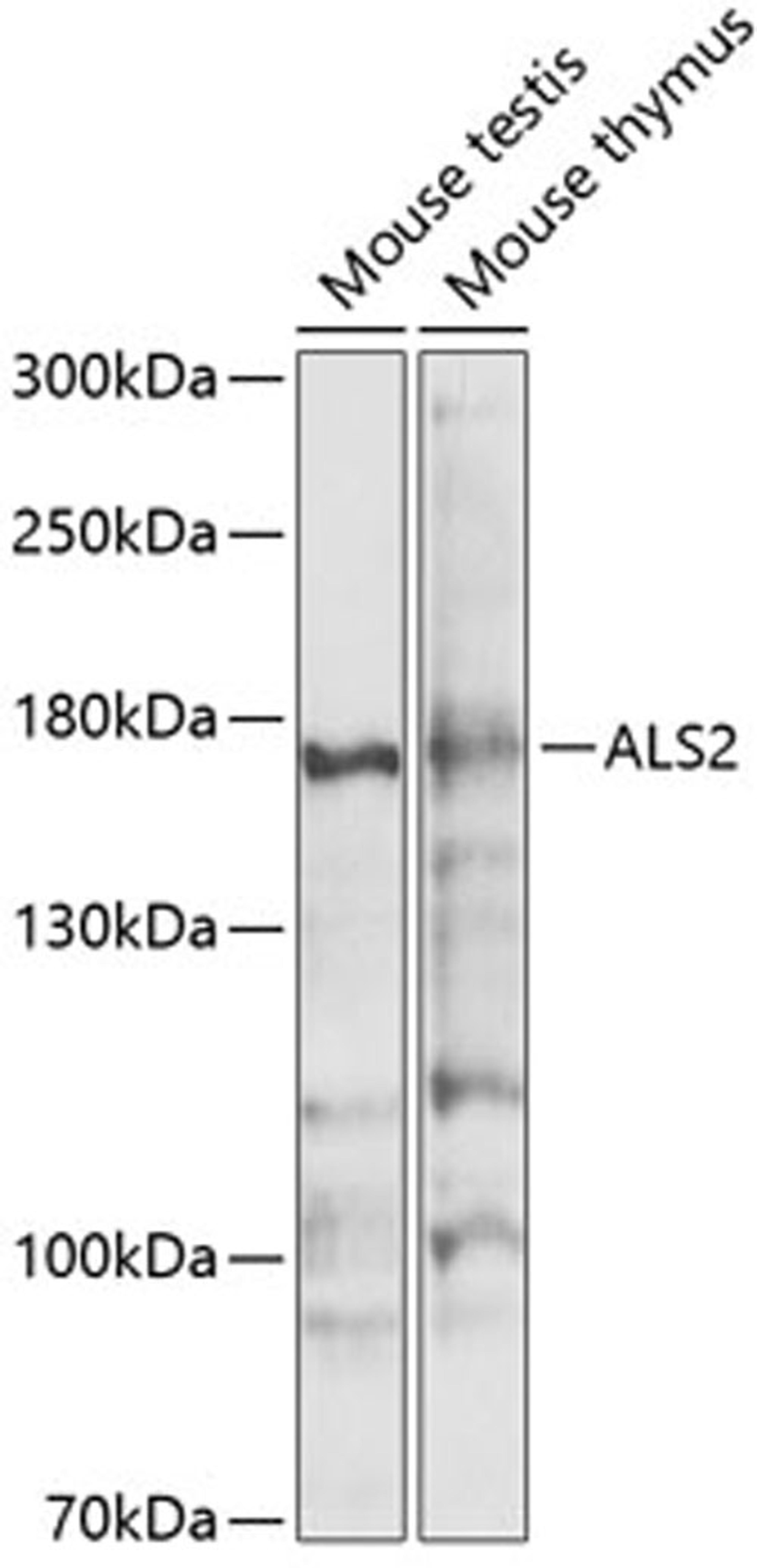 Western blot - ALS2 antibody (A4895)