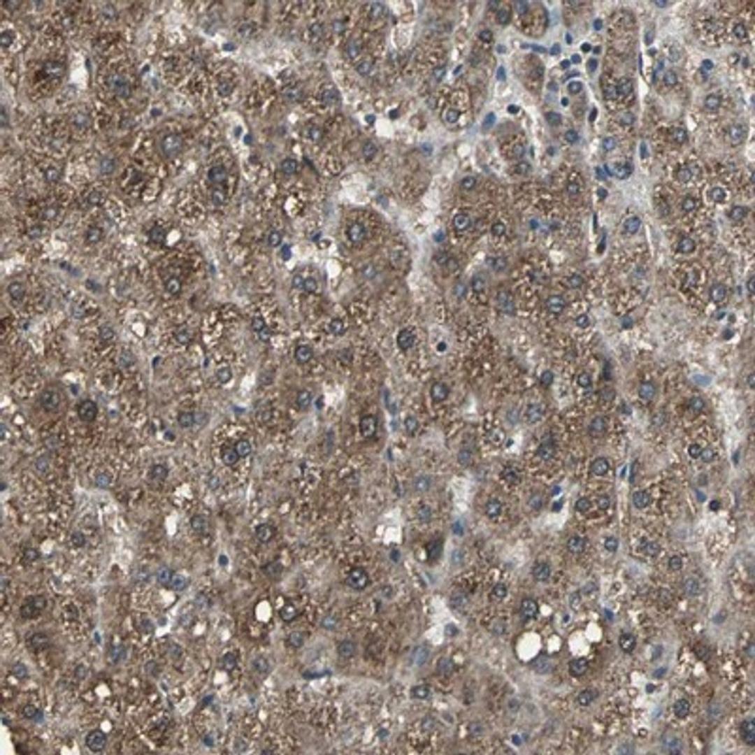 Immunohistochemistry-Paraffin: KIF1A Antibody [NBP1-88911] - Staining of human liver shows strong cytoplasmic positivity in hepatocytes.