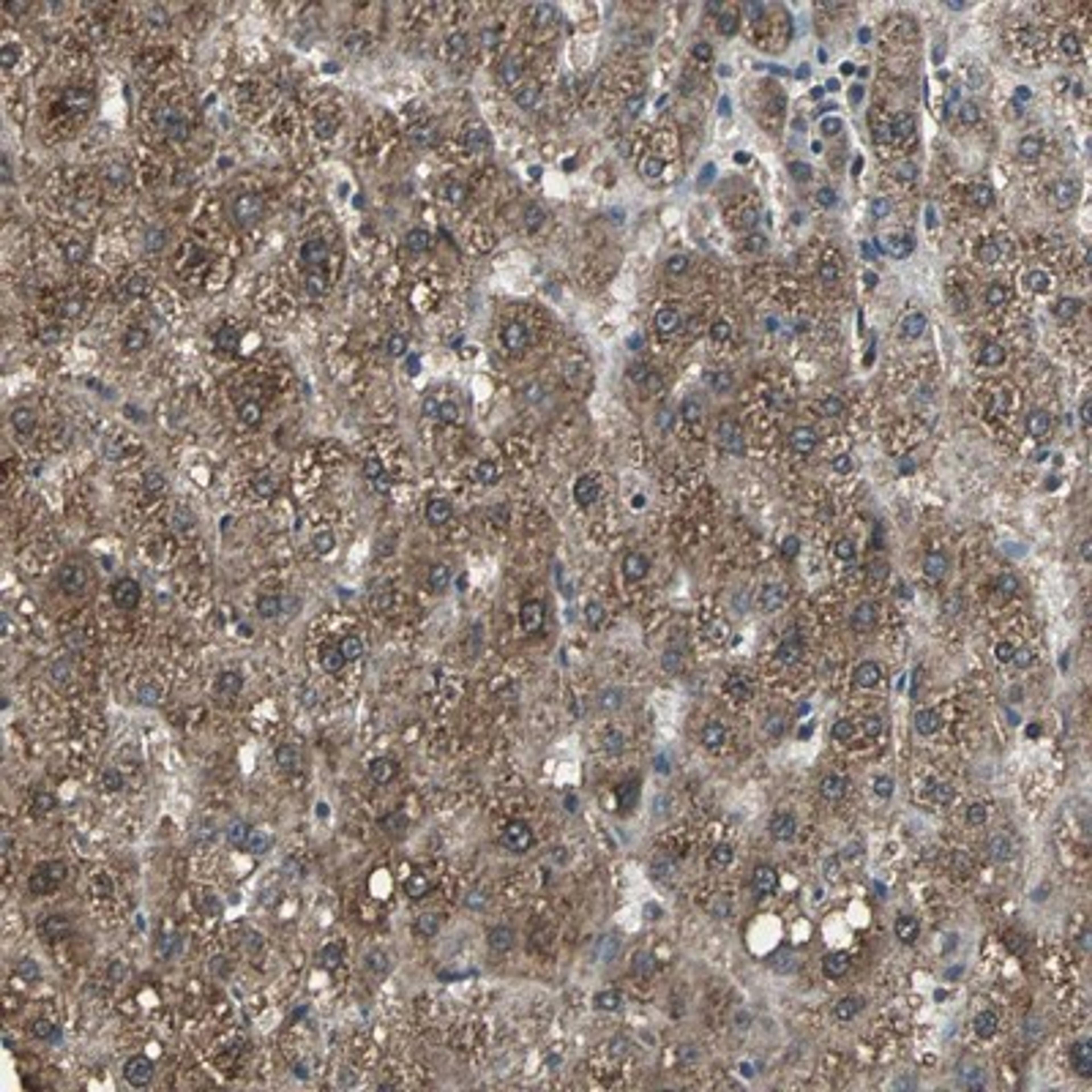 Immunohistochemistry-Paraffin: KIF1A Antibody [NBP1-88911] - Staining of human liver shows strong cytoplasmic positivity in hepatocytes.