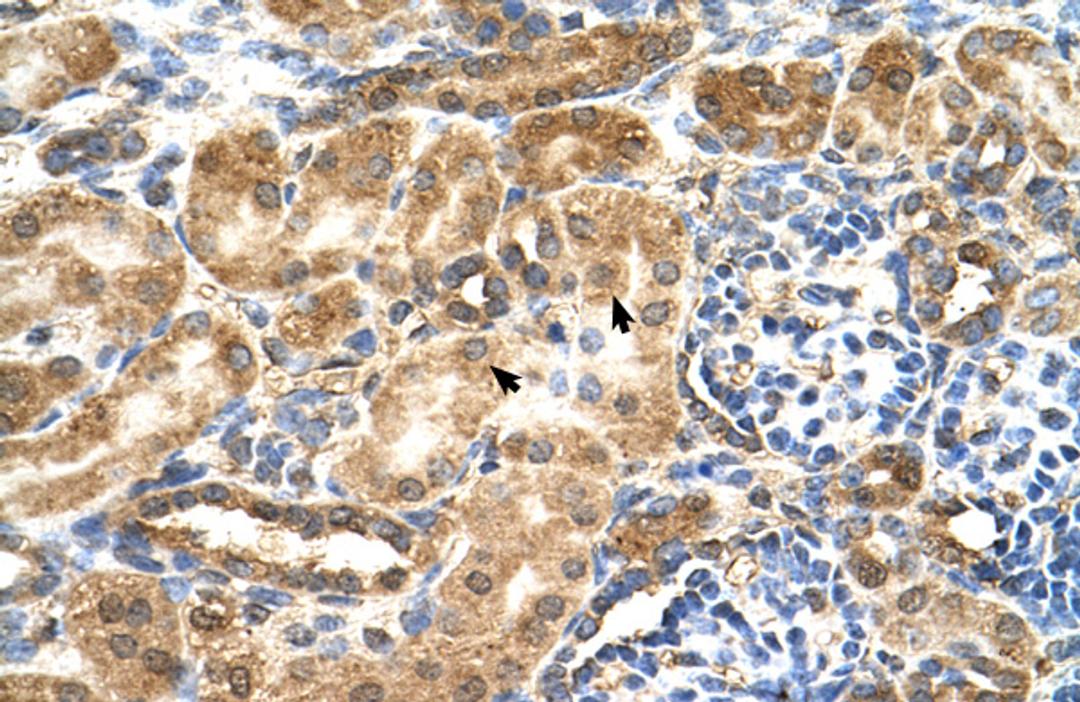 Antibody used in IHC on Human kidney.