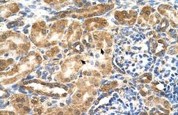 Antibody used in IHC on Human kidney.