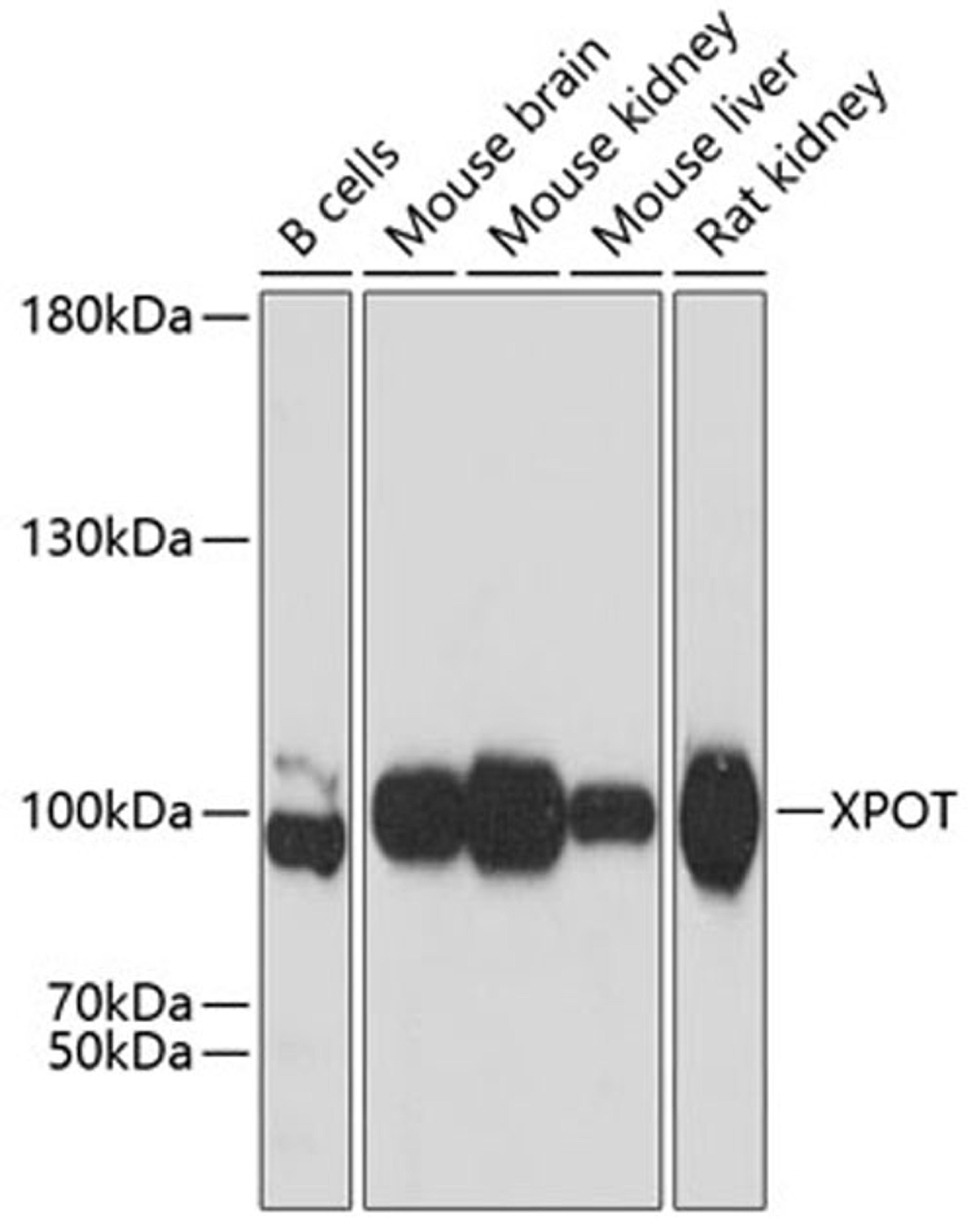 Western blot - XPOT antibody (A12043)