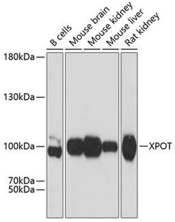 Western blot - XPOT antibody (A12043)
