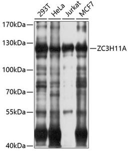 Western blot - ZC3H11A antibody (A10044)