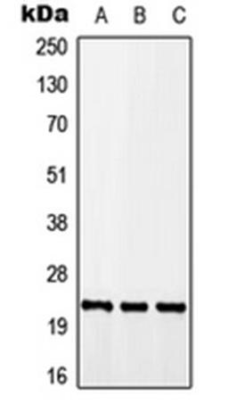 Western blot analysis of A549 (Lane 1), Raw264.7 (Lane 2), H9C2 (Lane 3) whole cell lysates using CALY antibody