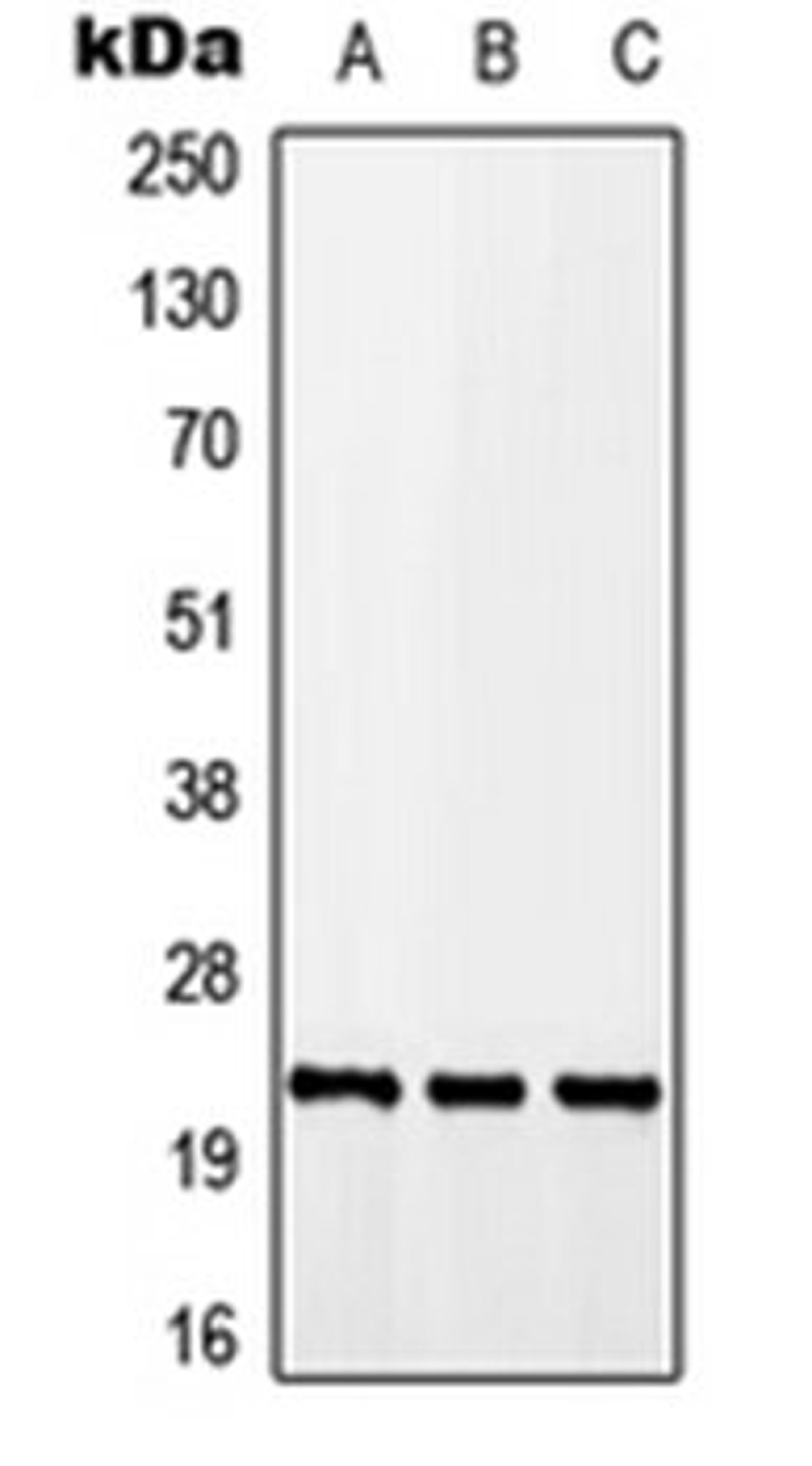 Western blot analysis of A549 (Lane 1), Raw264.7 (Lane 2), H9C2 (Lane 3) whole cell lysates using CALY antibody