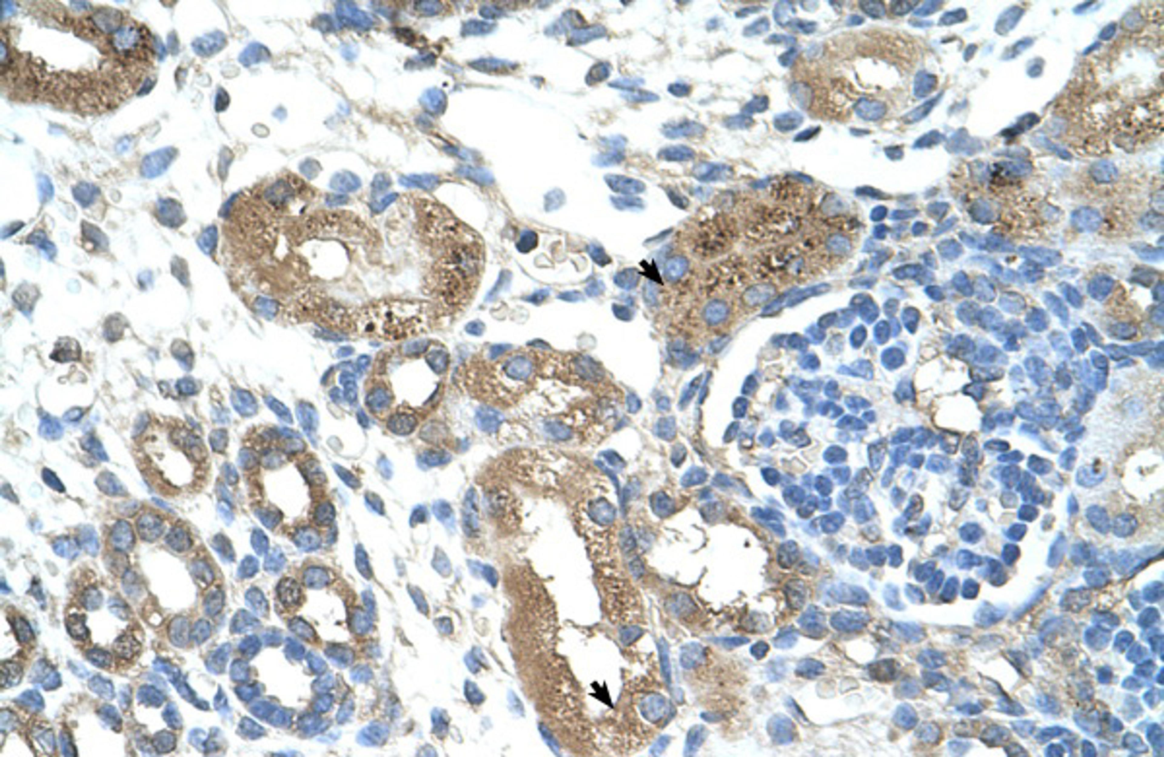 Antibody used in IHC on Human kidney.