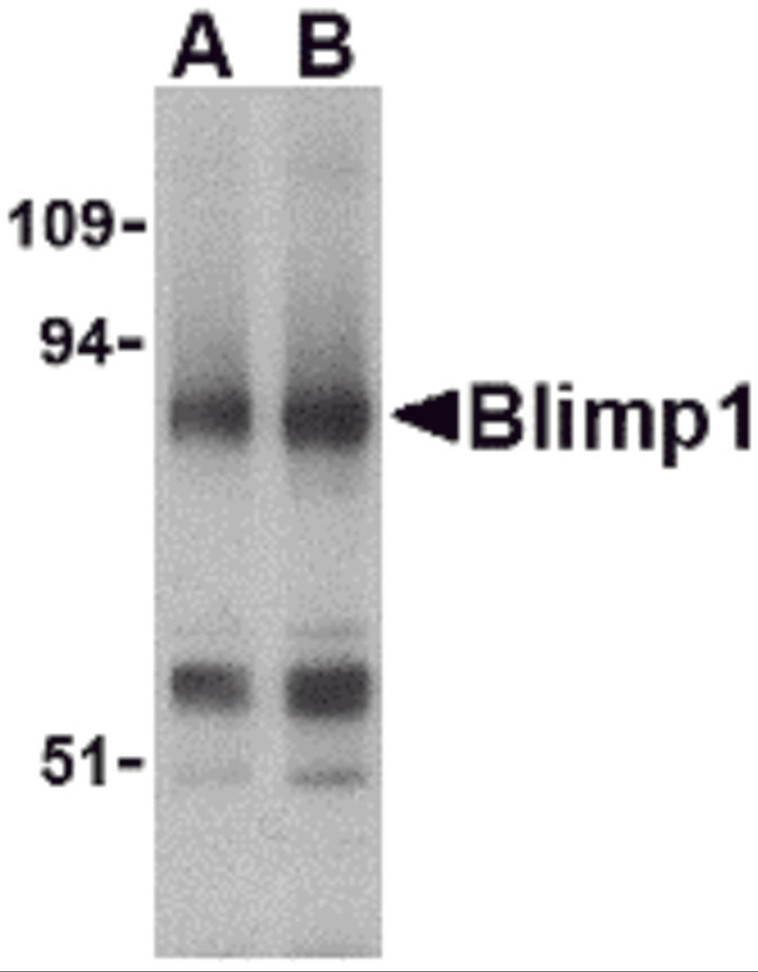 Western blot analysis of Blimp-1 in mouse lung tissue lysate with Blimp-1 antibody at (A) 0.5 and (B) 1&#956;g/mL. 