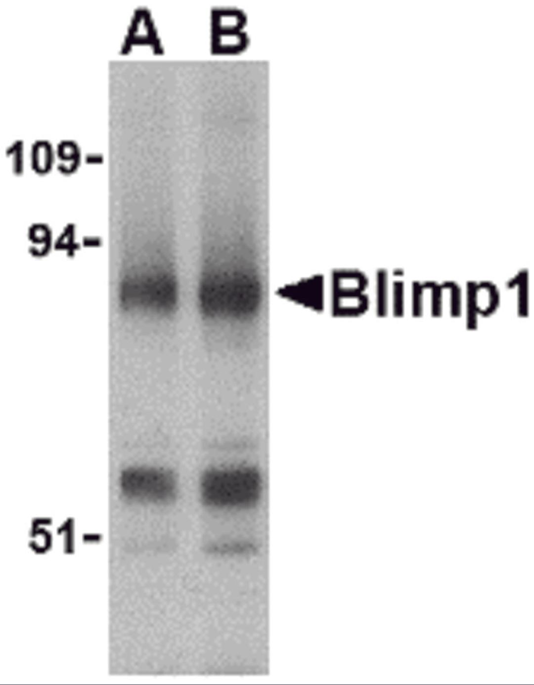 Western blot analysis of Blimp-1 in mouse lung tissue lysate with Blimp-1 antibody at (A) 0.5 and (B) 1μg/mL.
