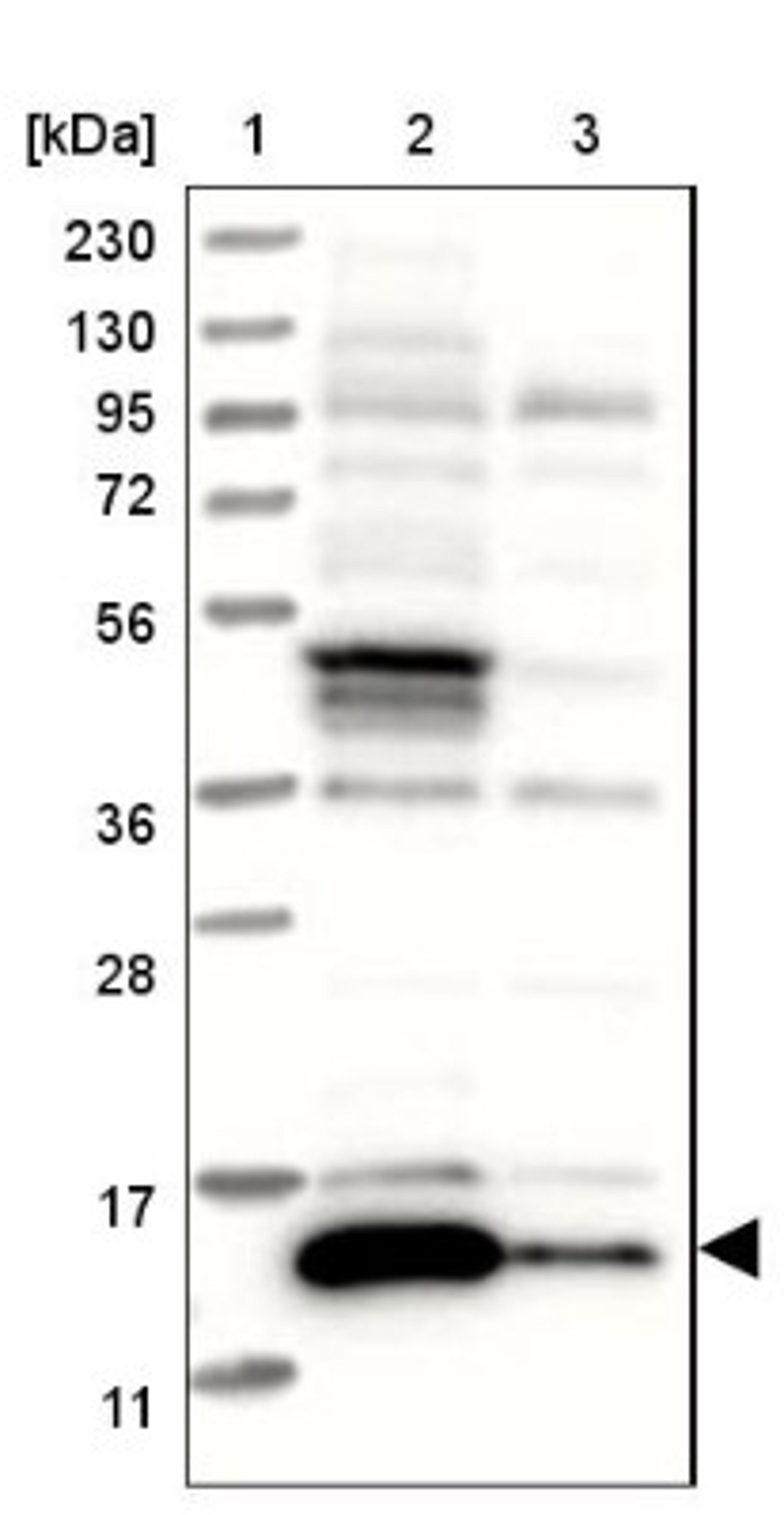 Western Blot: ATP6V1G3 Antibody [NBP1-88894] - Lane 1: Marker [kDa] 230, 130, 95, 72, 56, 36, 28, 17, 11<br/>Lane 2: Human cell line RT-4<br/>Lane 3: Human cell line U-251MG sp