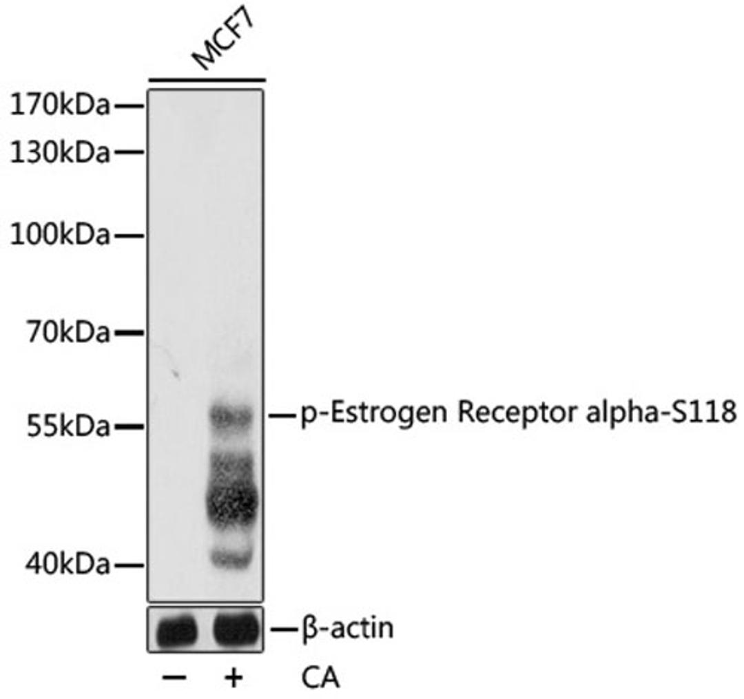 Western blot - Phospho-Estrogen Receptor alpha-S118 pAb (AP0146)