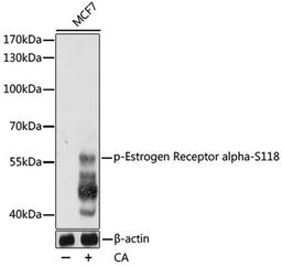 Western blot - Phospho-Estrogen Receptor alpha-S118 pAb (AP0146)