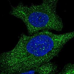 Immunocytochemistry/Immunofluorescence: alcohol dehydrogenase 7 Antibody [NBP1-90232] - Staining of human cell line U-2 OS shows positivity in cytoplasm.