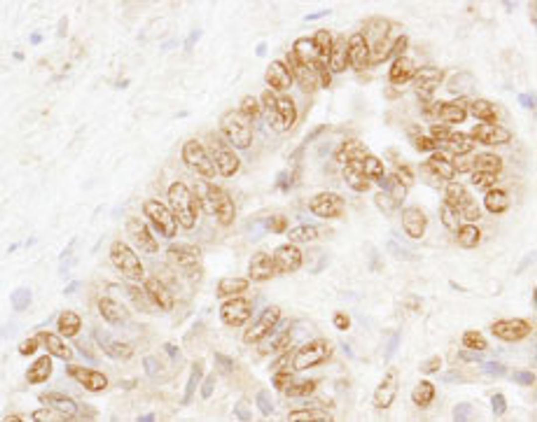 Detection of human CSTF77 by immunohistochemistry.