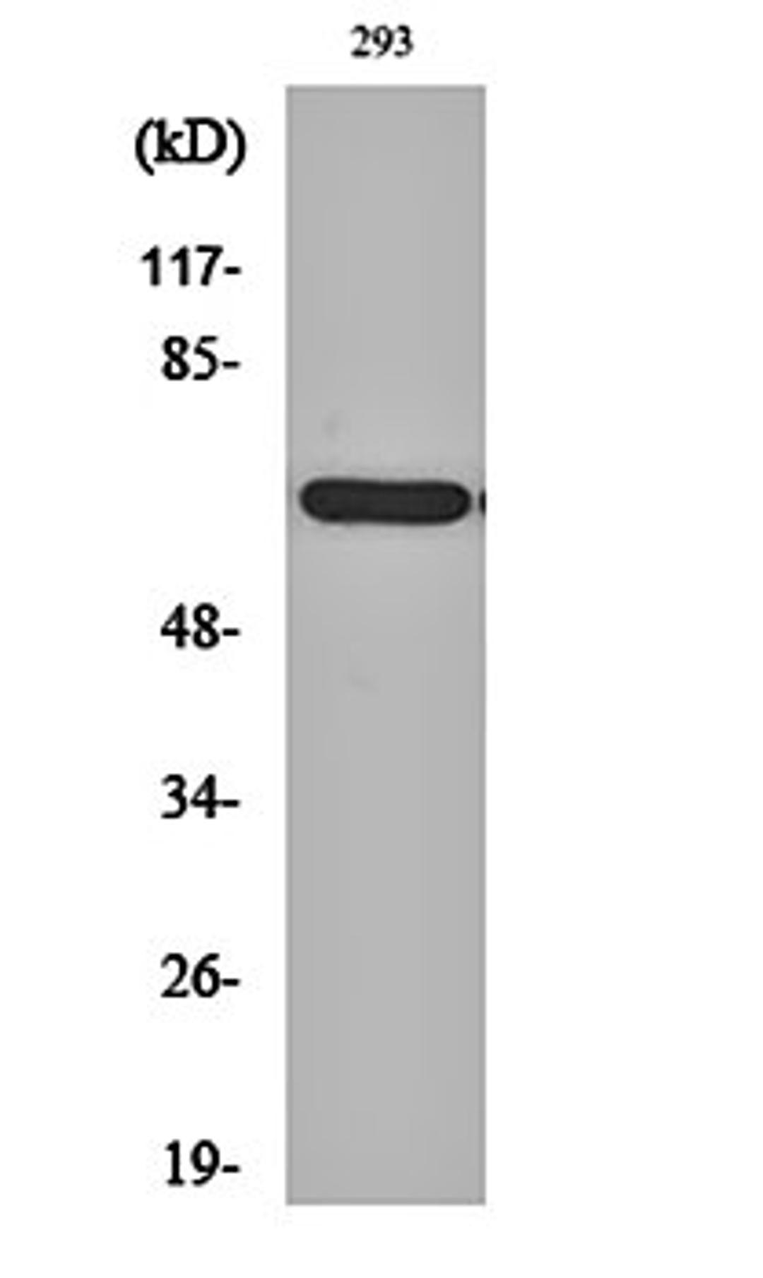 Western blot analysis of 293 cell lysates using POTE14/22 antibody