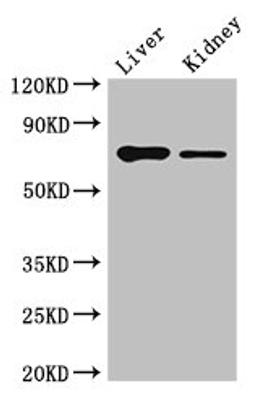 Western Blot. Positive WB detected in: Mouse liver tissue, Mouse kidney tissue. All lanes: DEF6 antibody at 4ug/ml. Secondary. Goat polyclonal to rabbit IgG at 1/50000 dilution. Predicted band size: 74 kDa. Observed band size: 74 kDa. 