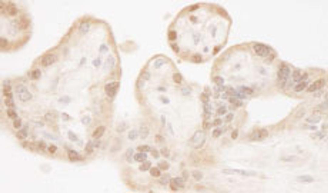 Detection of human MST1 and MST2 by immunohistochemistry.