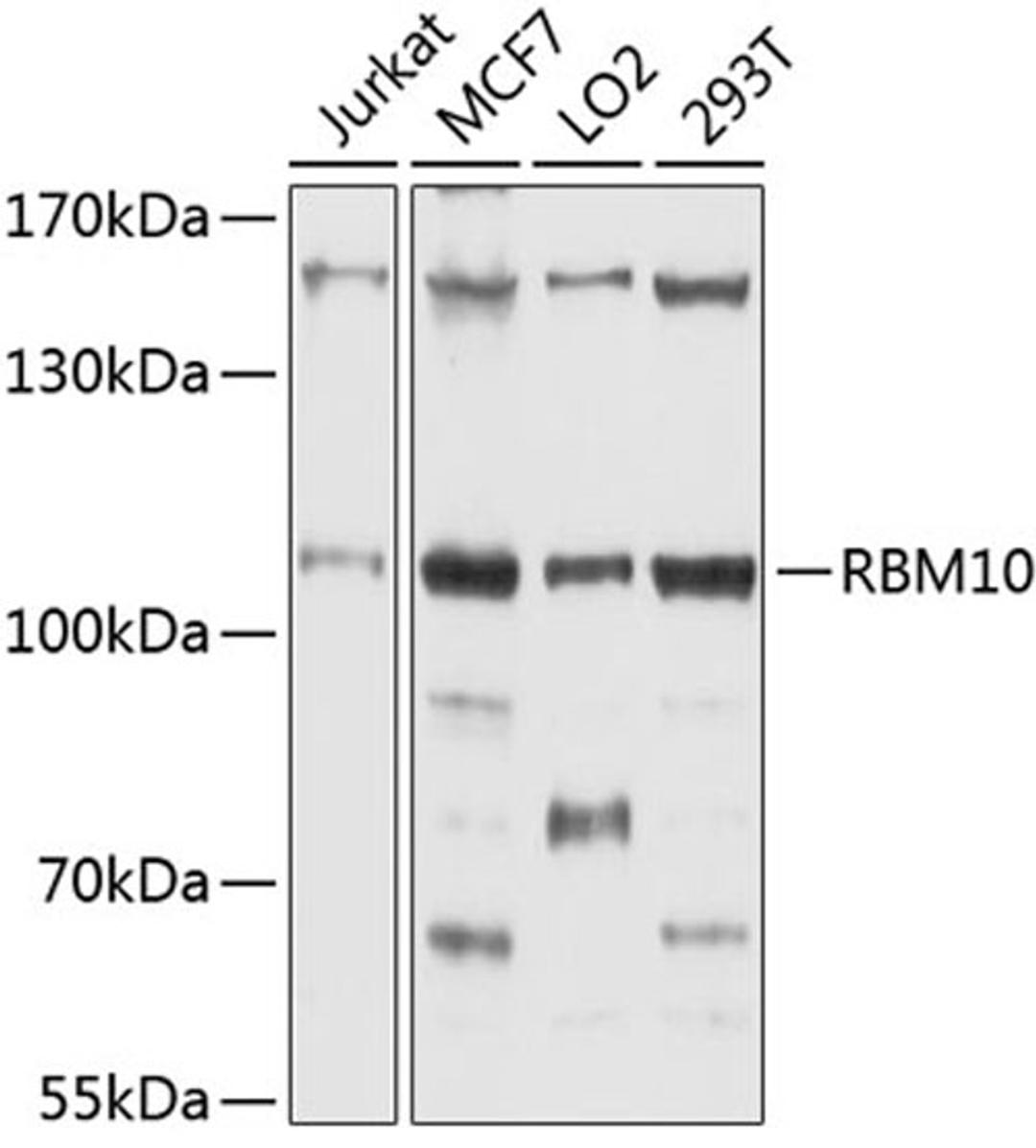 Western blot - RBM10 antibody (A4209)