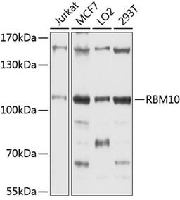 Western blot - RBM10 antibody (A4209)