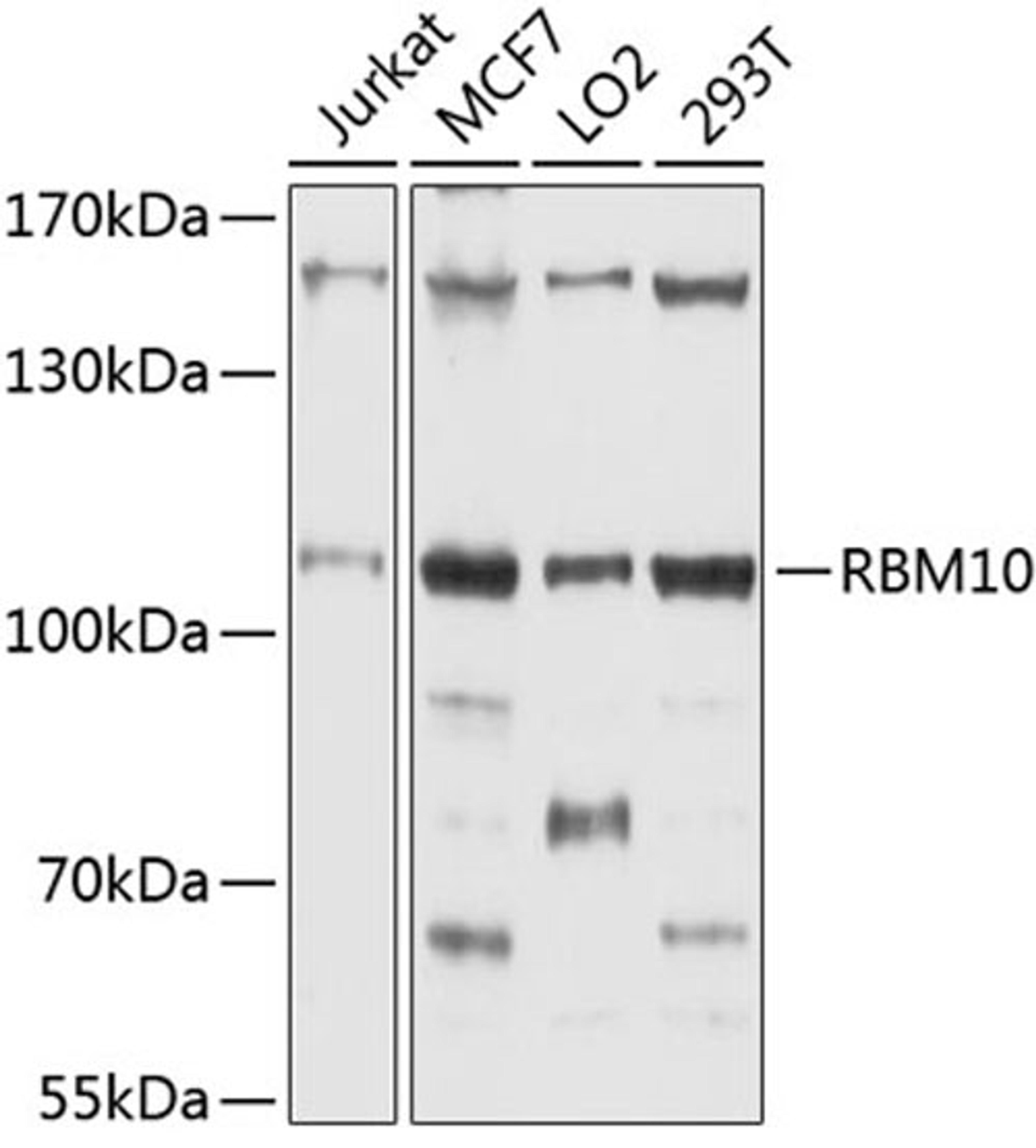 Western blot - RBM10 antibody (A4209)