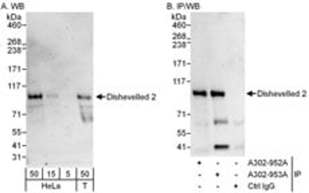 Detection of human Dishevelled 2 by western blot and immunoprecipitation.