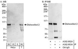 Detection of human Dishevelled 2 by western blot and immunoprecipitation.