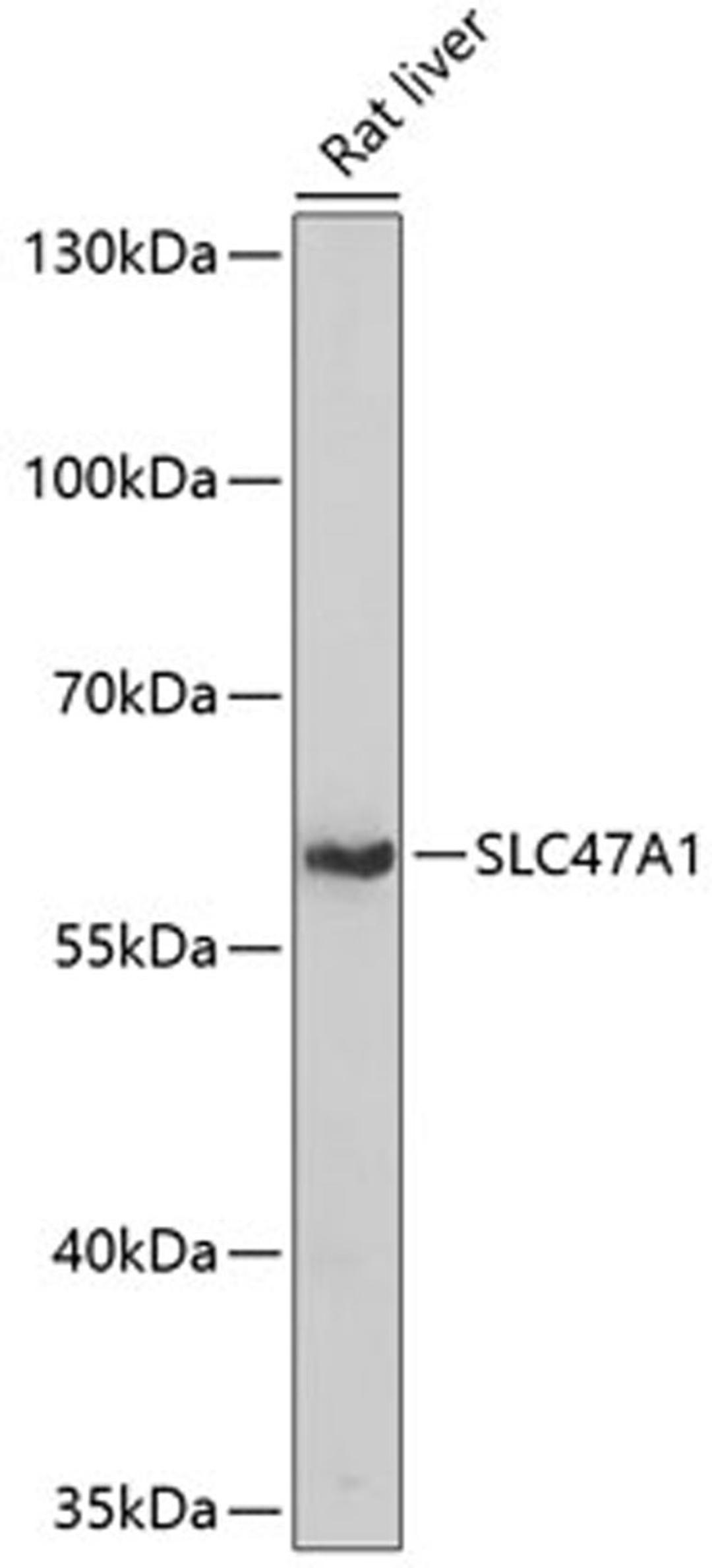 Western blot - SLC47A1 antibody (A14559)