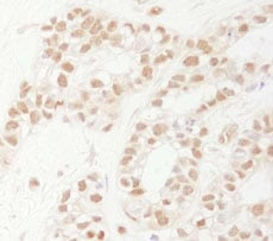 Detection of human Rad9 by immunohistochemistry.