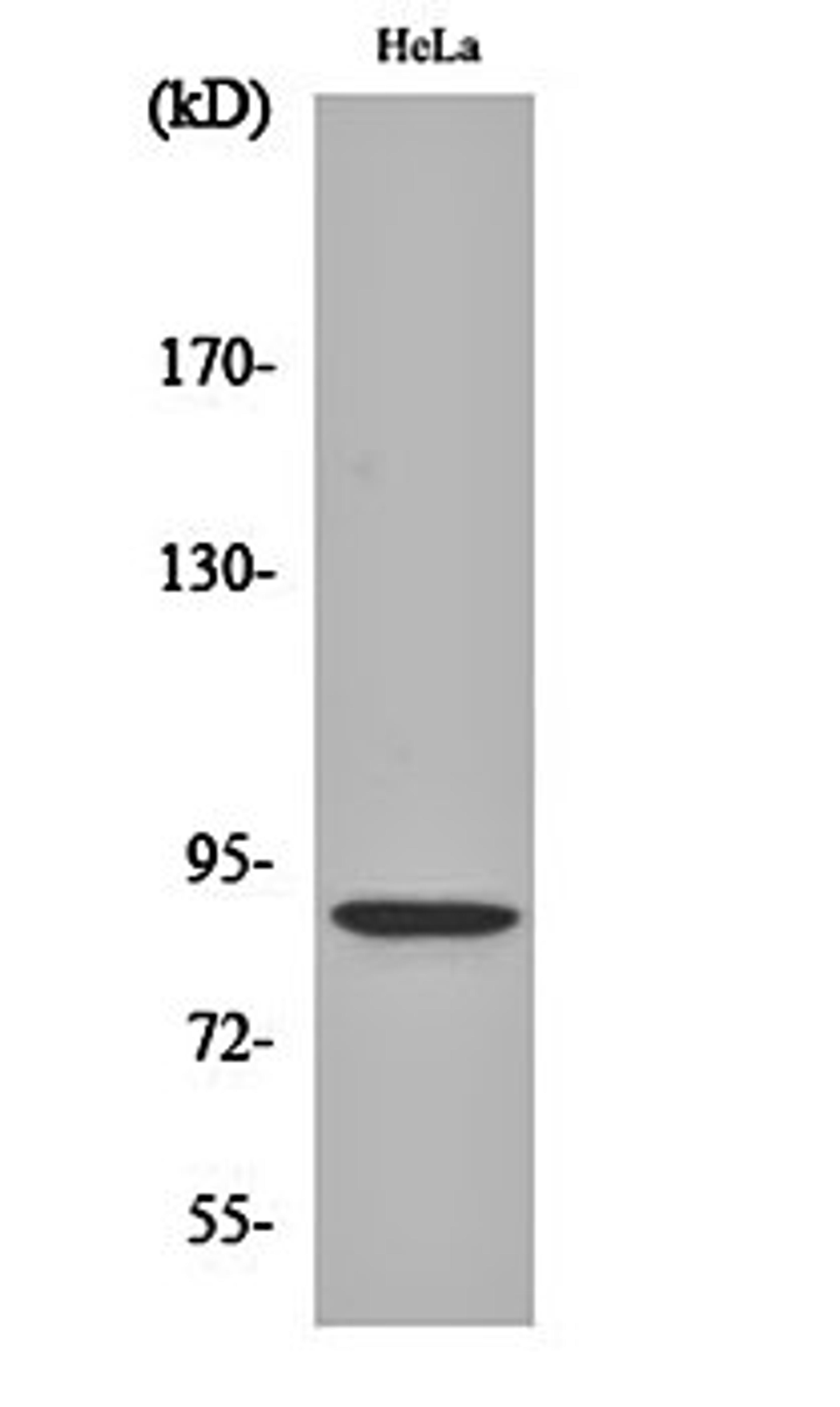 Western blot analysis of Hela cell lysates using Stat5 (phospho-S726/731) antibody