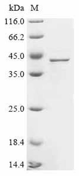 (Tris-Glycine gel) Discontinuous SDS-PAGE (reduced) with 5% enrichment gel and 15% separation gel.