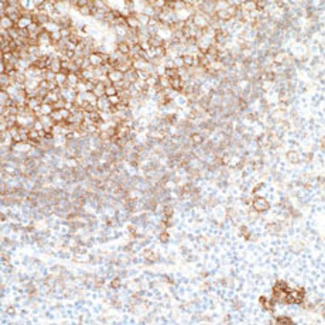 Detection of human CD40 by immunohistochemistry.