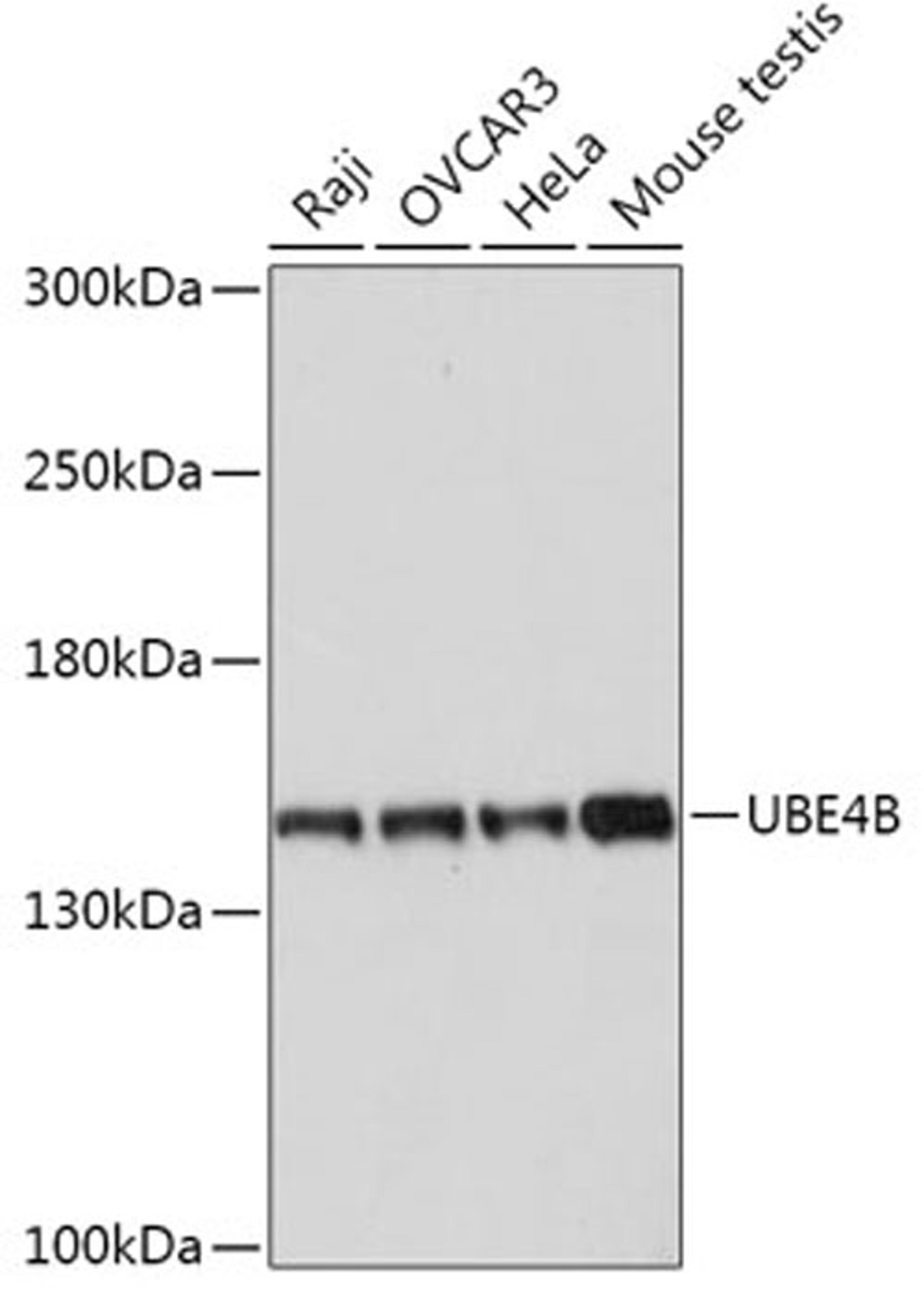 Western blot - UBE4B antibody (A17609)