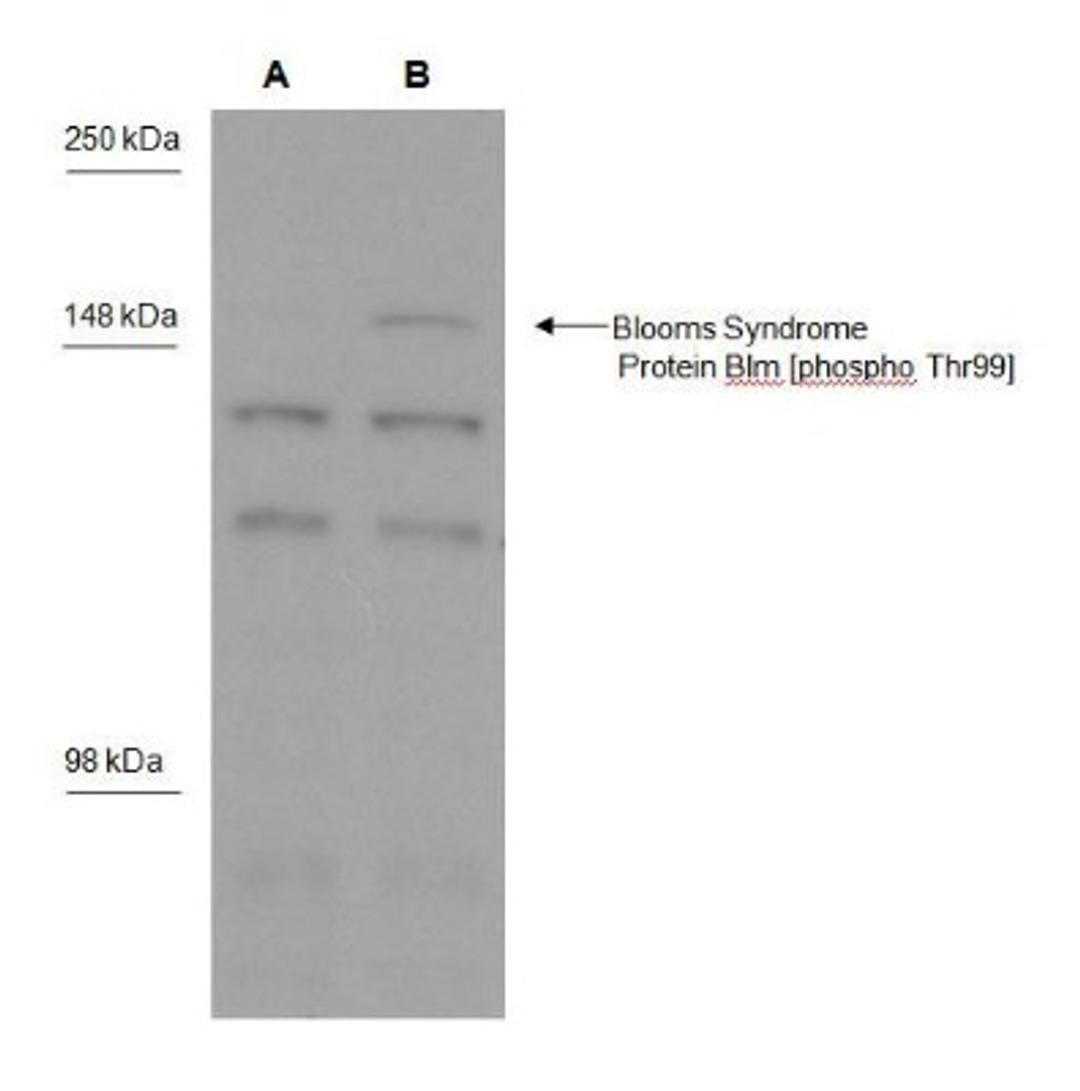 Western Blot: Blooms Syndrome Protein Blm [p Thr99] Antibody [NBP1-46851] - Western blot analysis of Blooms Syndrome Protein Blm phosphorylated at Thr99 in MDA-MB-231 cells A) not treated and B) treated with 1uM camptothecin using NBP1-46851.  Image courtesy of Dr. Keli Agama.