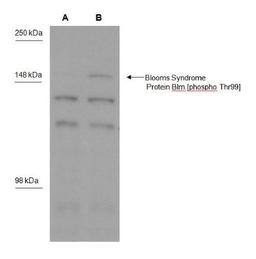 Western Blot: Blooms Syndrome Protein Blm [p Thr99] Antibody [NBP1-46851] - Western blot analysis of Blooms Syndrome Protein Blm phosphorylated at Thr99 in MDA-MB-231 cells A) not treated and B) treated with 1uM camptothecin using NBP1-46851.  Image courtesy of Dr. Keli Agama.