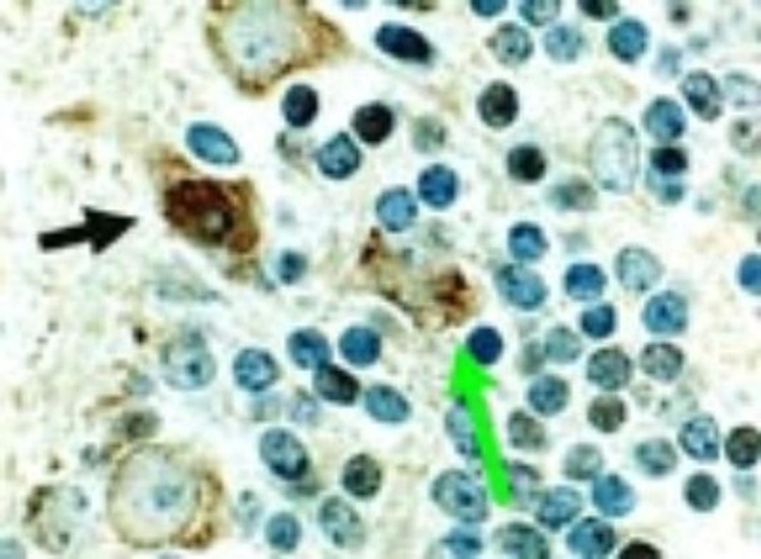 Immunohistochemistry: Cre Antibody [NB100-56133] - Immunohistochemical analysis of Cre in a formalin-fixed, paraffin embedded tissue section from the cerebellum of a Cre transgenic mouse using NB100-56133 at 1:2000. In this mouse line, Cre is expressed in the brain, predominantly in the nuclei of most types of neurons. The arrow denotes an example of a stained neuron. Cre staining is also seen in the cytosol of cerebellar Purkinje cells. Hematoxylin-eosin counterstain.