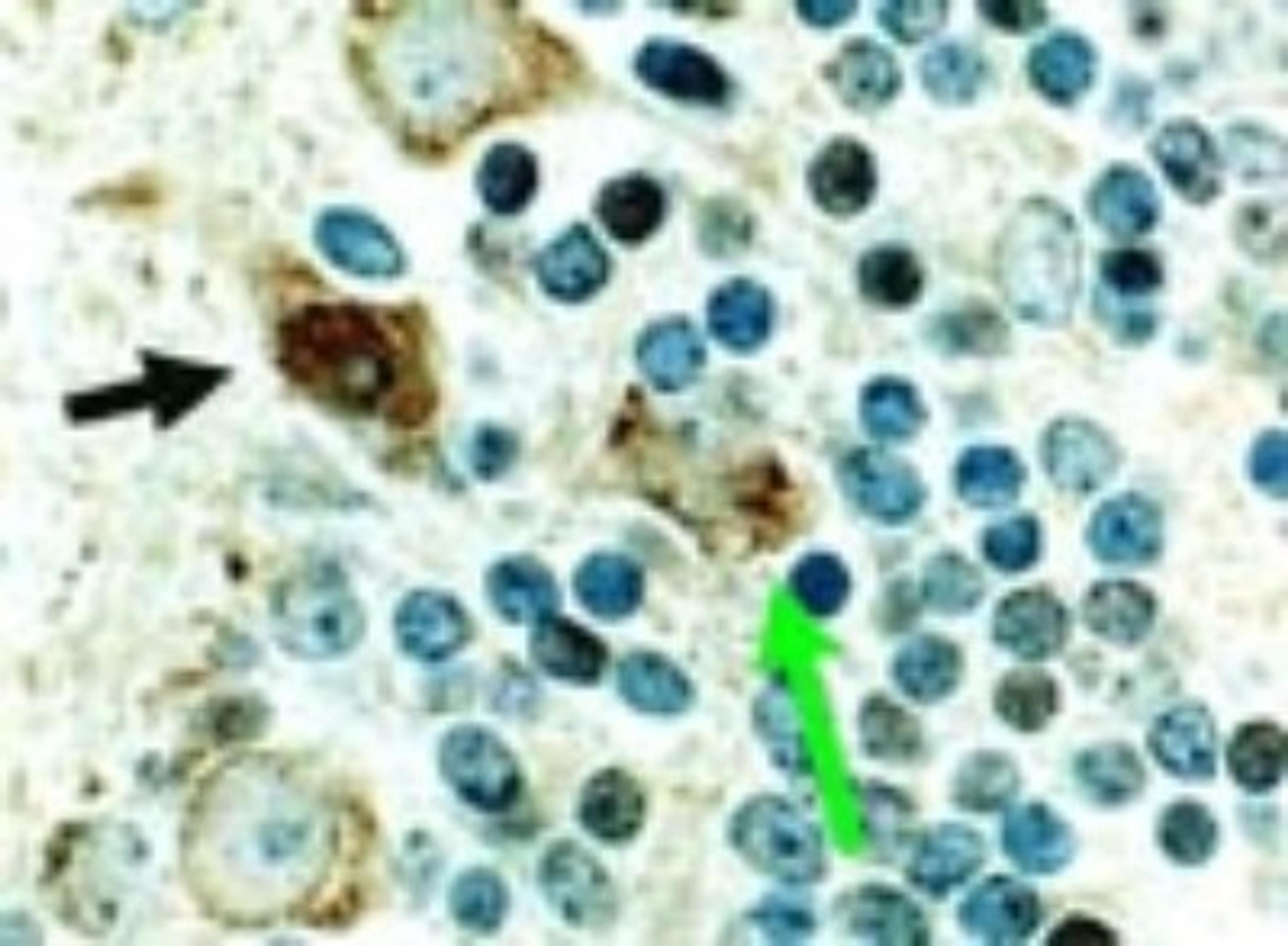 Immunohistochemistry: Cre Antibody [NB100-56133] - Immunohistochemical analysis of Cre in a formalin-fixed, paraffin embedded tissue section from the cerebellum of a Cre transgenic mouse using NB100-56133 at 1:2000. In this mouse line, Cre is expressed in the brain, predominantly in the nuclei of most types of neurons. The arrow denotes an example of a stained neuron. Cre staining is also seen in the cytosol of cerebellar Purkinje cells. Hematoxylin-eosin counterstain.