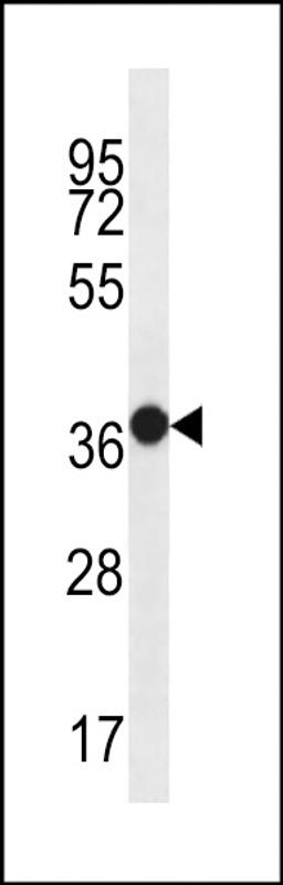 Western blot analysis in WiDr cell line lysates (35ug/lane).