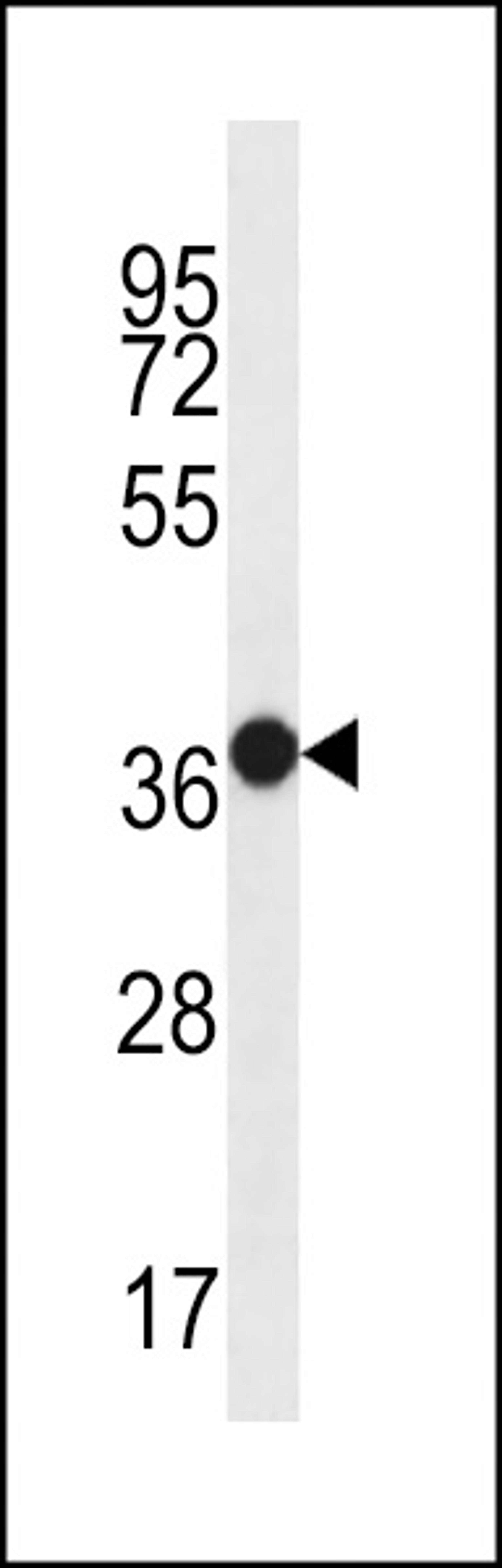 Western blot analysis in WiDr cell line lysates (35ug/lane).