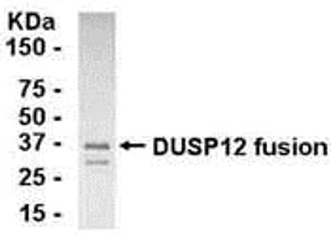 E coli-derived fusion protein as test antigen. Affinity-purified IgY dilution: 1:2000, Goat anti-IgY-HRP dilution: 1:1000. Colorimetric method for signal development.