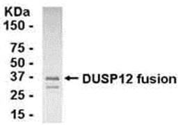 E coli-derived fusion protein as test antigen. Affinity-purified IgY dilution: 1:2000, Goat anti-IgY-HRP dilution: 1:1000. Colorimetric method for signal development.