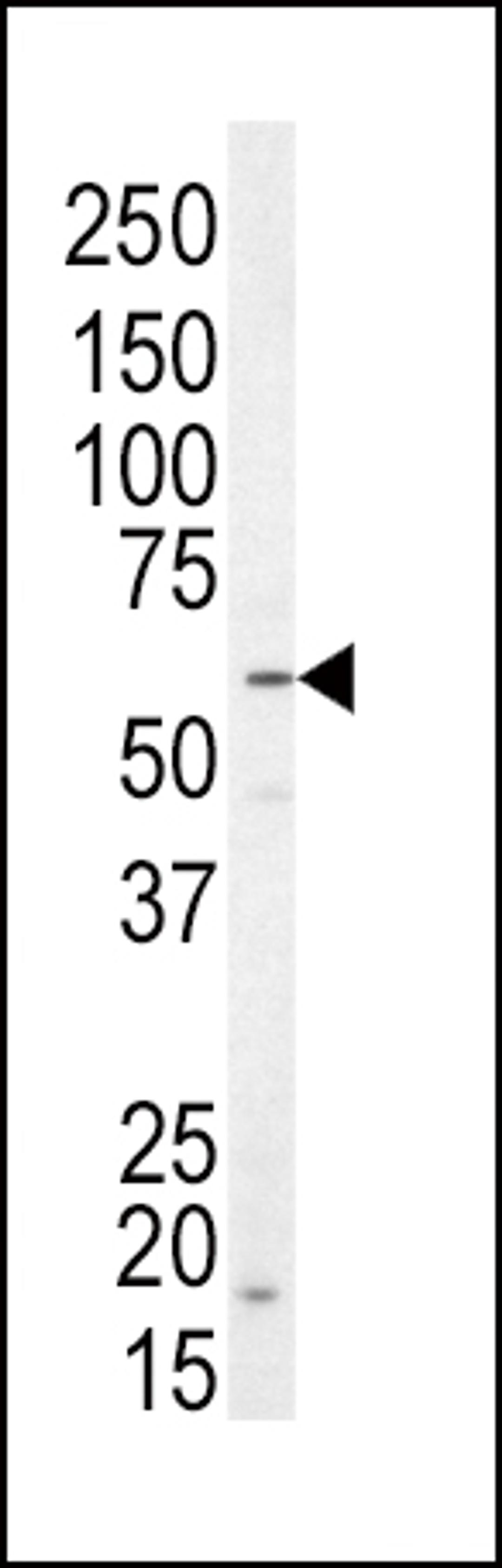 Western blot analysis of anti-NRG1 Antibody in SK-BR-3 cell line lysates (35ug/lane)