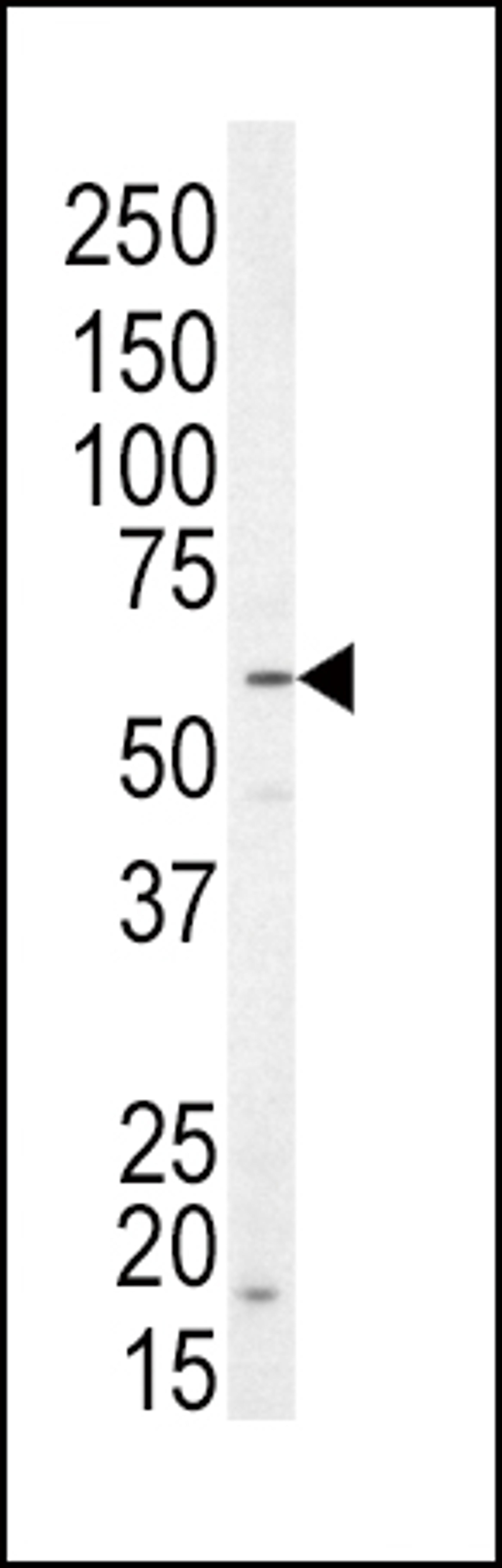 Western blot analysis of anti-NRG1 Antibody in SK-BR-3 cell line lysates (35ug/lane)