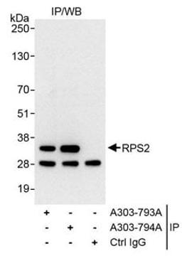 Detection of human RPS2 by western blot of immunoprecipitates.