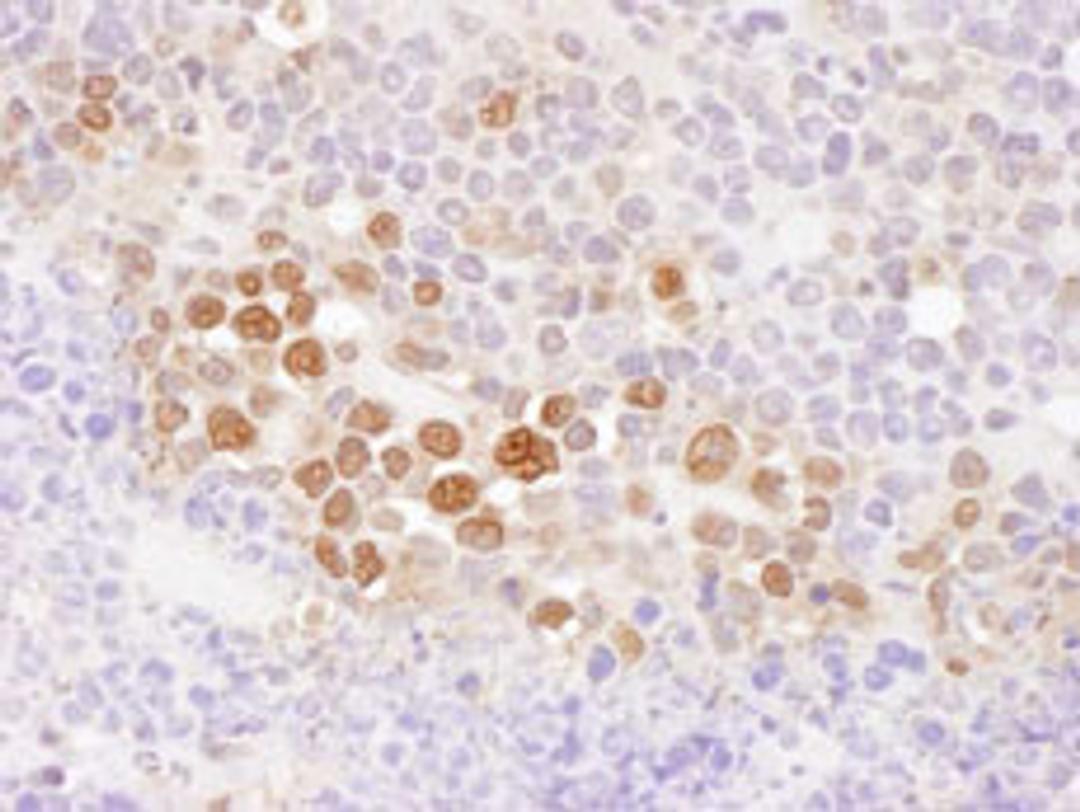 Detection of mouse CSE1 by immunohistochemistry.