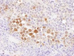 Detection of mouse CSE1 by immunohistochemistry.