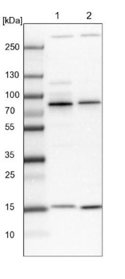 Western Blot: ANKRD13A Antibody [NBP1-89082] - Lane 1: NIH-3T3 cell lysate (Mouse embryonic fibroblast cells)<br/>Lane 2: NBT-II cell lysate (Rat Wistar bladder tumour cells)