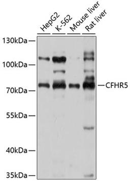 Western blot - CFHR5 antibody (A10367)