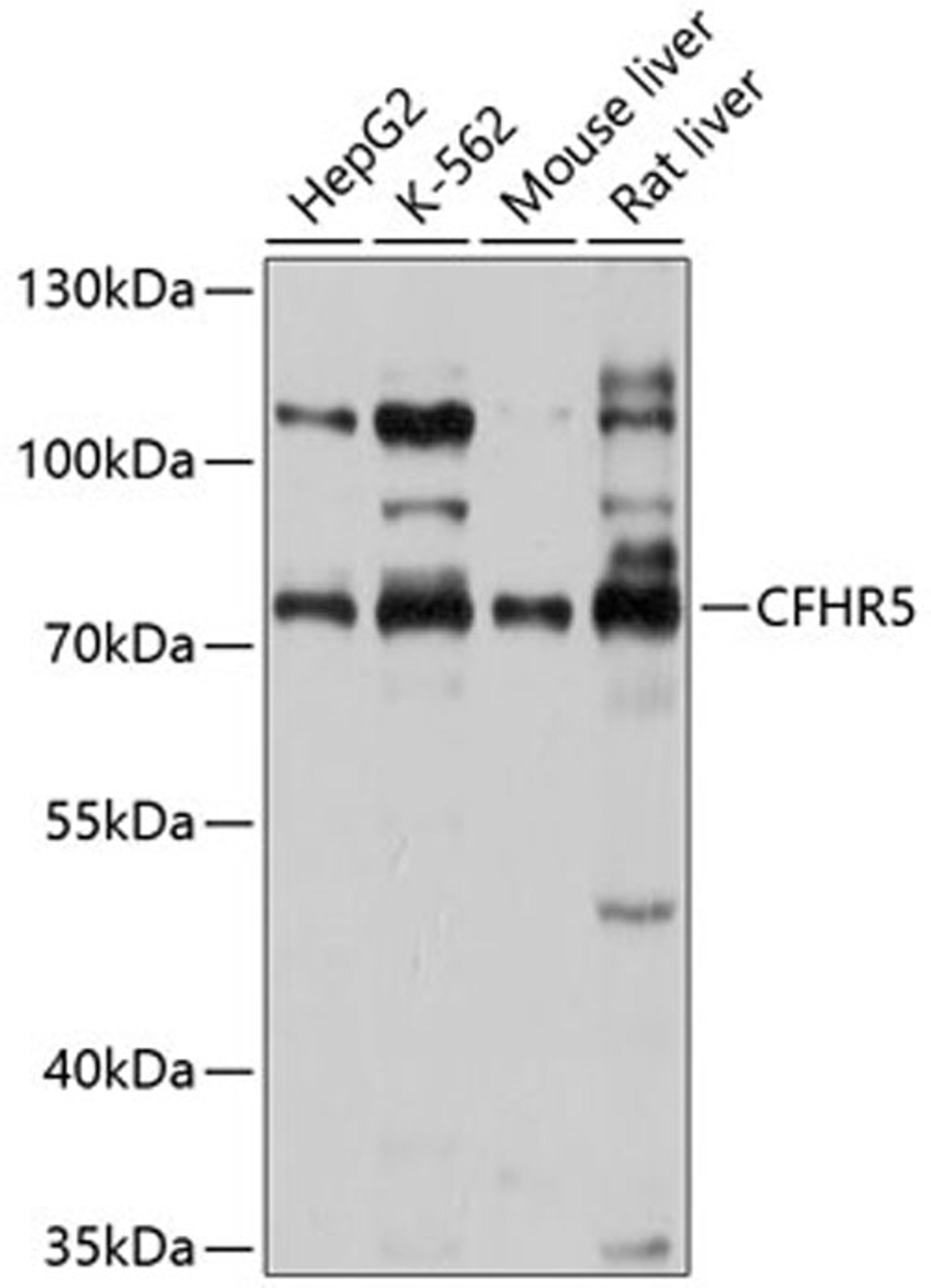 Western blot - CFHR5 antibody (A10367)